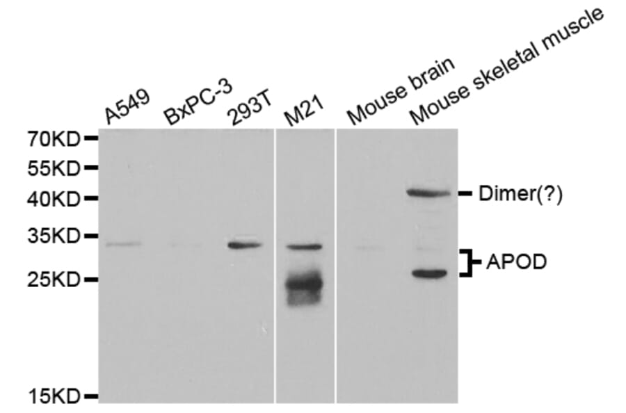 Western blot - APOD Antibody from Signalway Antibody (32751) - Antibodies.com