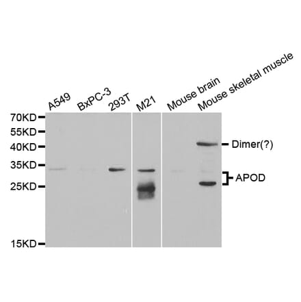 Western blot - APOD Antibody from Signalway Antibody (32751) - Antibodies.com