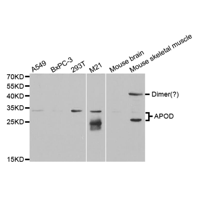 Western blot - APOD Antibody from Signalway Antibody (32751) - Antibodies.com