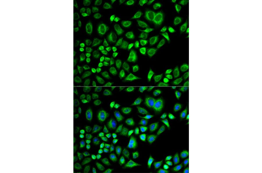 Immunofluorescence - APOD Antibody from Signalway Antibody (32751) - Antibodies.com