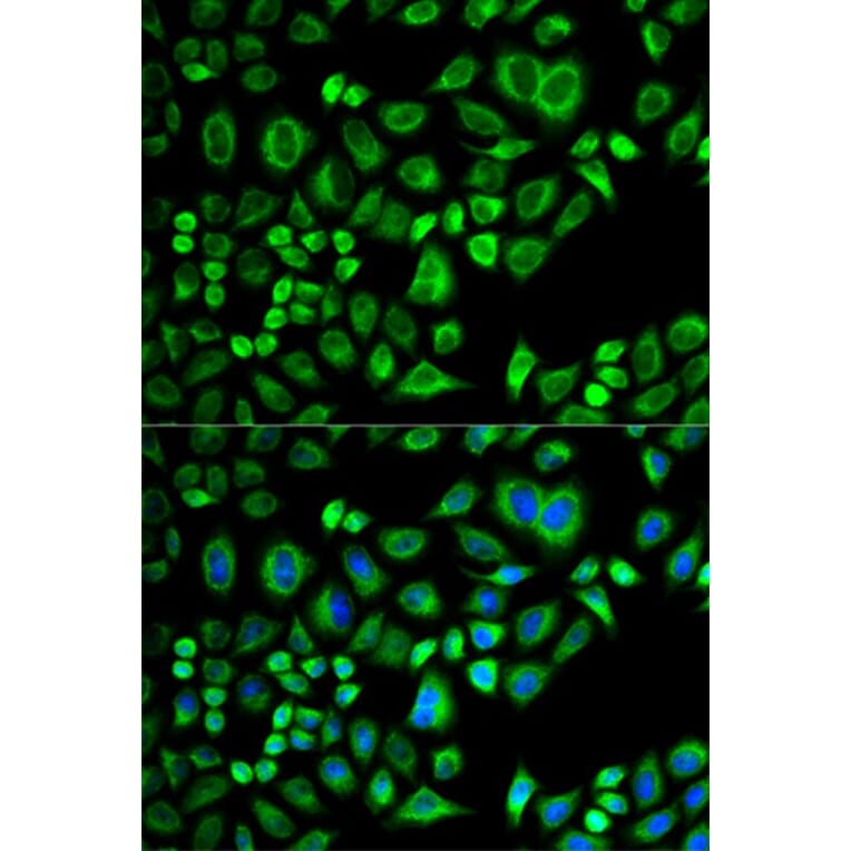 Immunofluorescence - APOD Antibody from Signalway Antibody (32751) - Antibodies.com