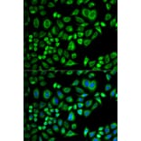 Immunofluorescence - APOD Antibody from Signalway Antibody (32751) - Antibodies.com