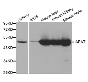 Western blot - ABAT Antibody from Signalway Antibody (32753) - Antibodies.com