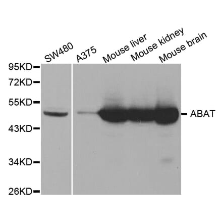 Western blot - ABAT Antibody from Signalway Antibody (32753) - Antibodies.com