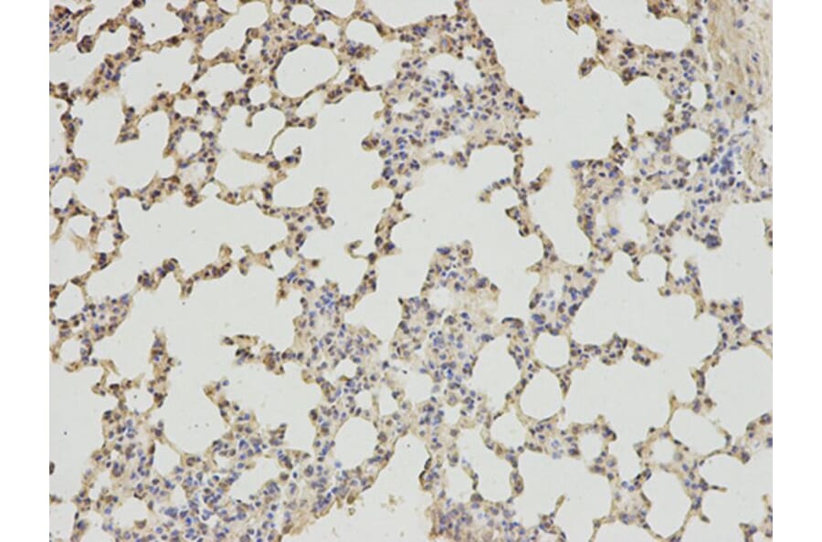Immunohistochemistry - ABAT Antibody from Signalway Antibody (32753) - Antibodies.com