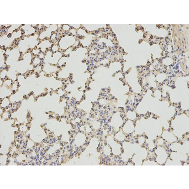 Immunohistochemistry - ABAT Antibody from Signalway Antibody (32753) - Antibodies.com