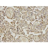 Immunohistochemistry - ABAT Antibody from Signalway Antibody (32753) - Antibodies.com