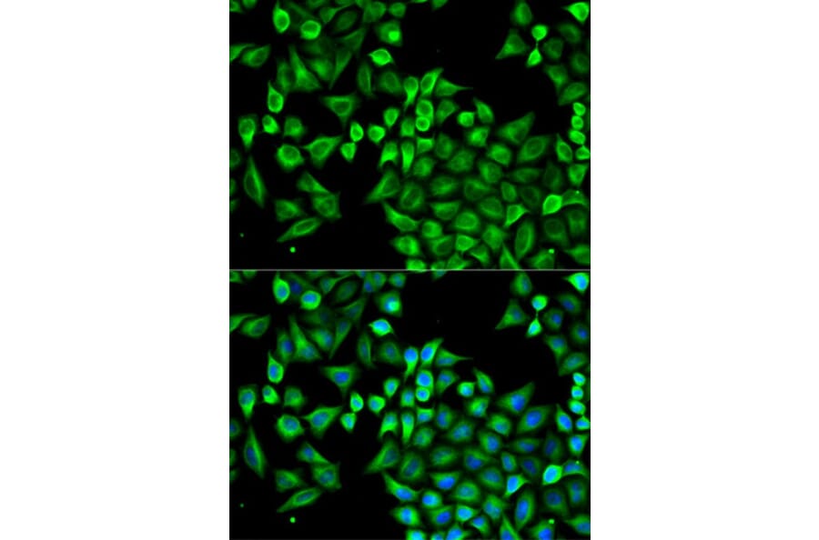 Immunofluorescence - ABAT Antibody from Signalway Antibody (32753) - Antibodies.com