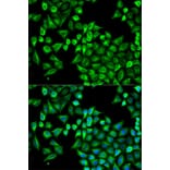 Immunofluorescence - ABAT Antibody from Signalway Antibody (32753) - Antibodies.com