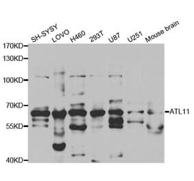 Western blot - ATL1 Antibody from Signalway Antibody (32756) - Antibodies.com