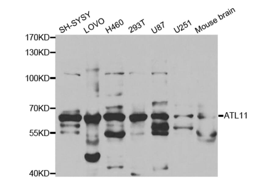 Western blot - ATL1 Antibody from Signalway Antibody (32756) - Antibodies.com
