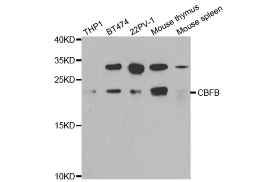 Western blot - CBFB Antibody from Signalway Antibody (32759) - Antibodies.com