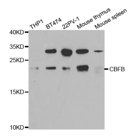 Western blot - CBFB Antibody from Signalway Antibody (32759) - Antibodies.com