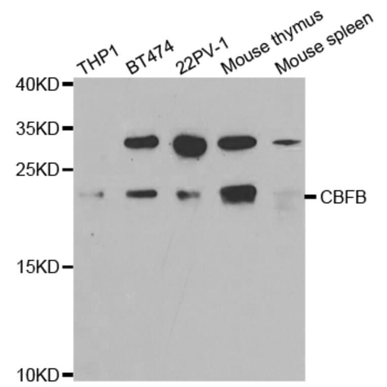 Western blot - CBFB Antibody from Signalway Antibody (32759) - Antibodies.com