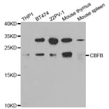 Western blot - CBFB Antibody from Signalway Antibody (32759) - Antibodies.com