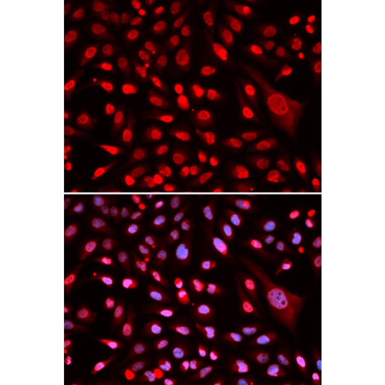 Immunofluorescence - CBFB Antibody from Signalway Antibody (32759) - Antibodies.com