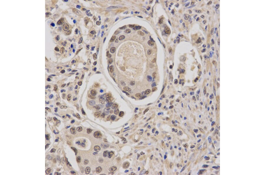 Immunohistochemistry - CBFB Antibody from Signalway Antibody (32759) - Antibodies.com