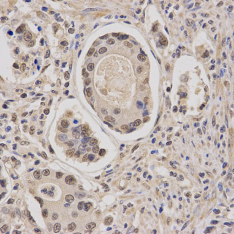 Immunohistochemistry - CBFB Antibody from Signalway Antibody (32759) - Antibodies.com