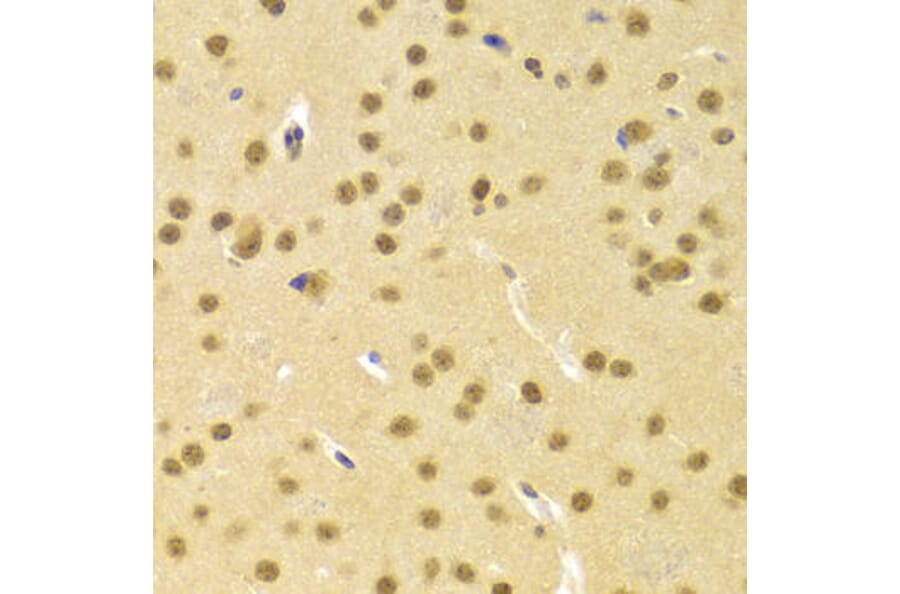 Immunohistochemistry - CBFB Antibody from Signalway Antibody (32759) - Antibodies.com