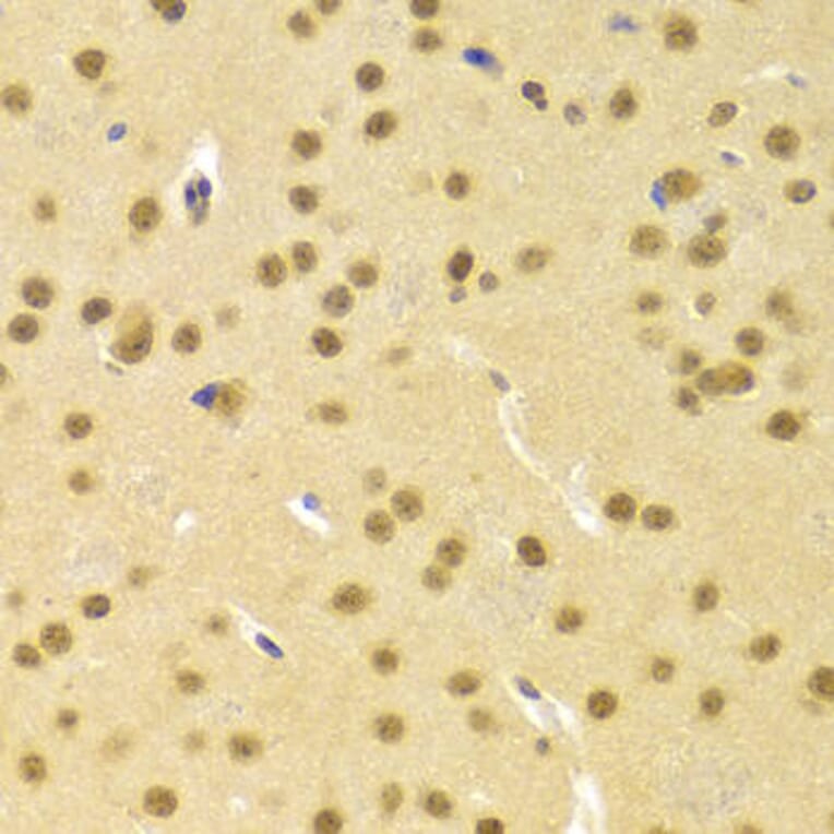 Immunohistochemistry - CBFB Antibody from Signalway Antibody (32759) - Antibodies.com