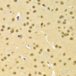 Immunohistochemistry - CBFB Antibody from Signalway Antibody (32759) - Antibodies.com
