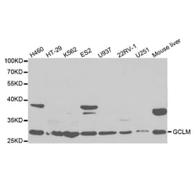 Western blot - GCLM Antibody from Signalway Antibody (32765) - Antibodies.com
