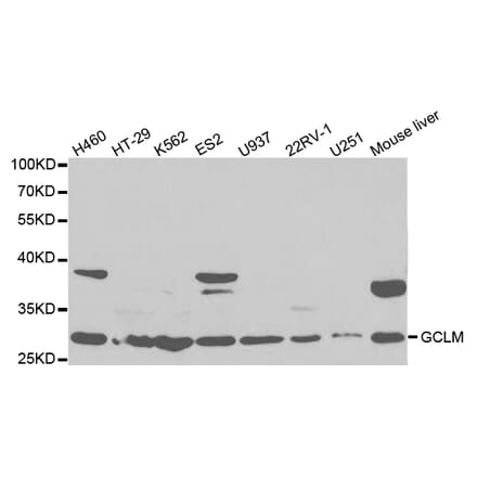 Western blot - GCLM Antibody from Signalway Antibody (32765) - Antibodies.com