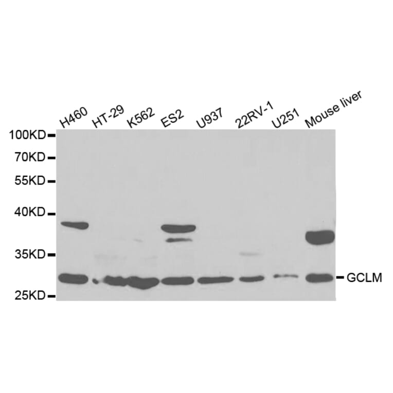 Western blot - GCLM Antibody from Signalway Antibody (32765) - Antibodies.com