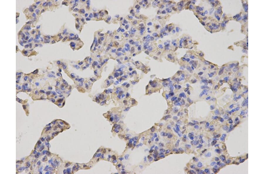 Immunohistochemistry - GCLM Antibody from Signalway Antibody (32765) - Antibodies.com