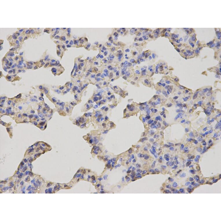 Immunohistochemistry - GCLM Antibody from Signalway Antibody (32765) - Antibodies.com