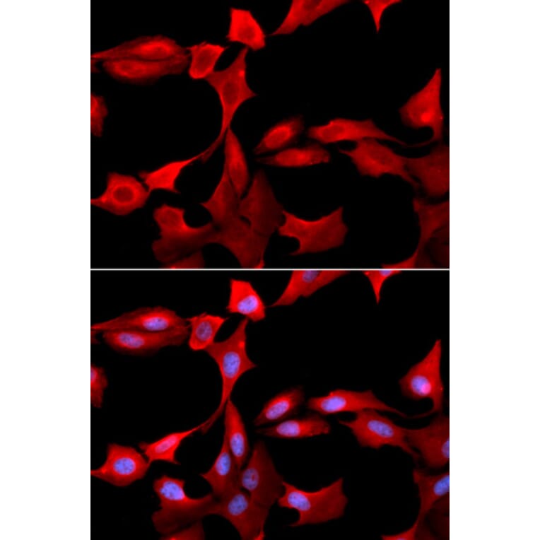 Immunofluorescence - GCLM Antibody from Signalway Antibody (32765) - Antibodies.com