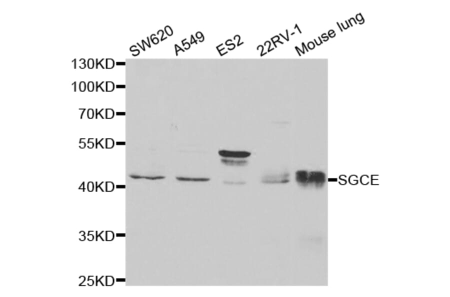 Western blot - SGCE Antibody from Signalway Antibody (32776) - Antibodies.com