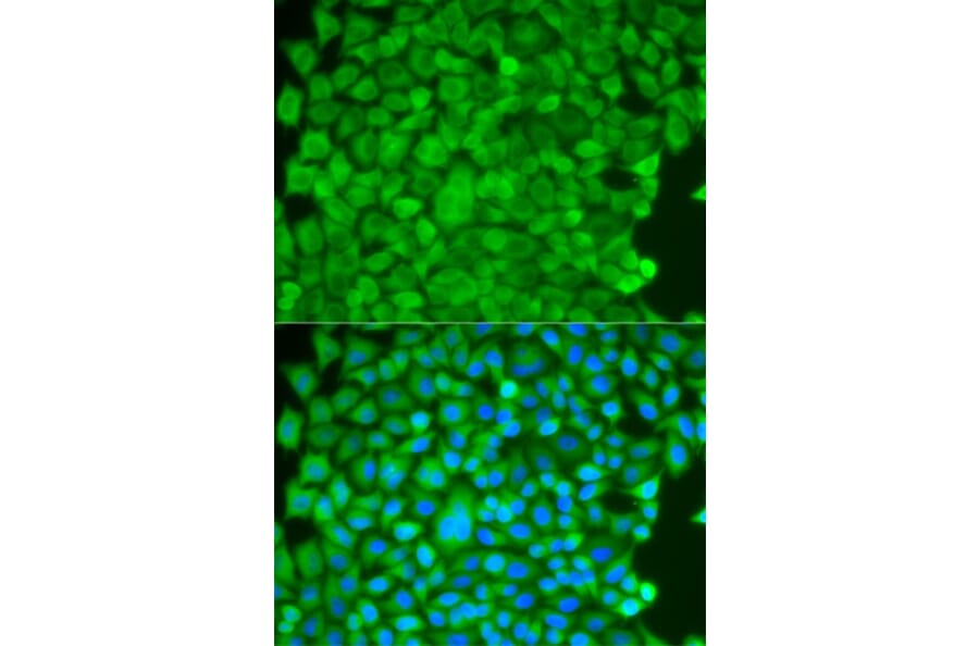 Immunofluorescence - SGCE Antibody from Signalway Antibody (32776) - Antibodies.com
