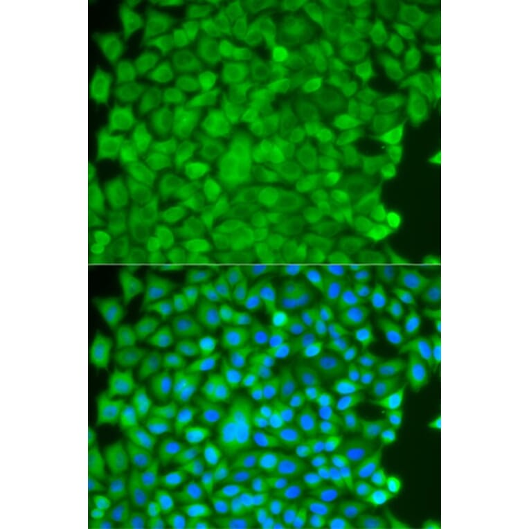 Immunofluorescence - SGCE Antibody from Signalway Antibody (32776) - Antibodies.com