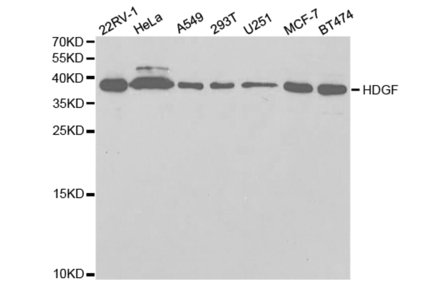 Western blot - HDGF Antibody from Signalway Antibody (32788) - Antibodies.com