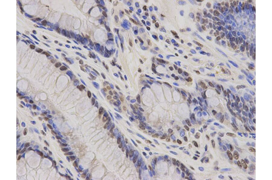 Immunohistochemistry - HDGF Antibody from Signalway Antibody (32788) - Antibodies.com