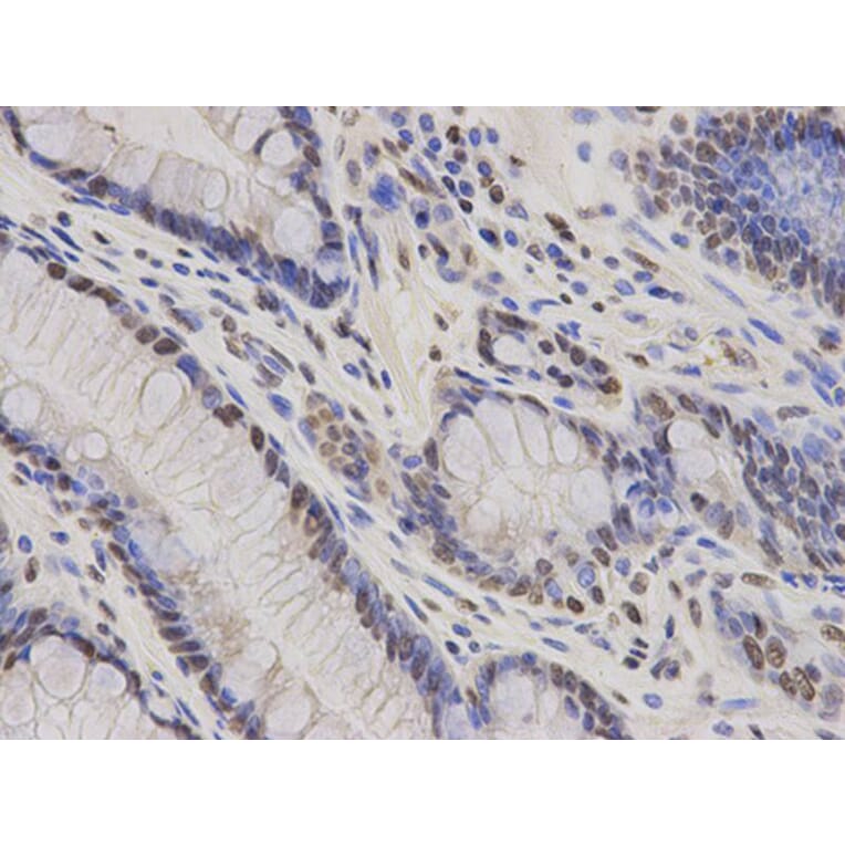 Immunohistochemistry - HDGF Antibody from Signalway Antibody (32788) - Antibodies.com