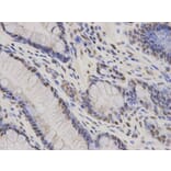 Immunohistochemistry - HDGF Antibody from Signalway Antibody (32788) - Antibodies.com