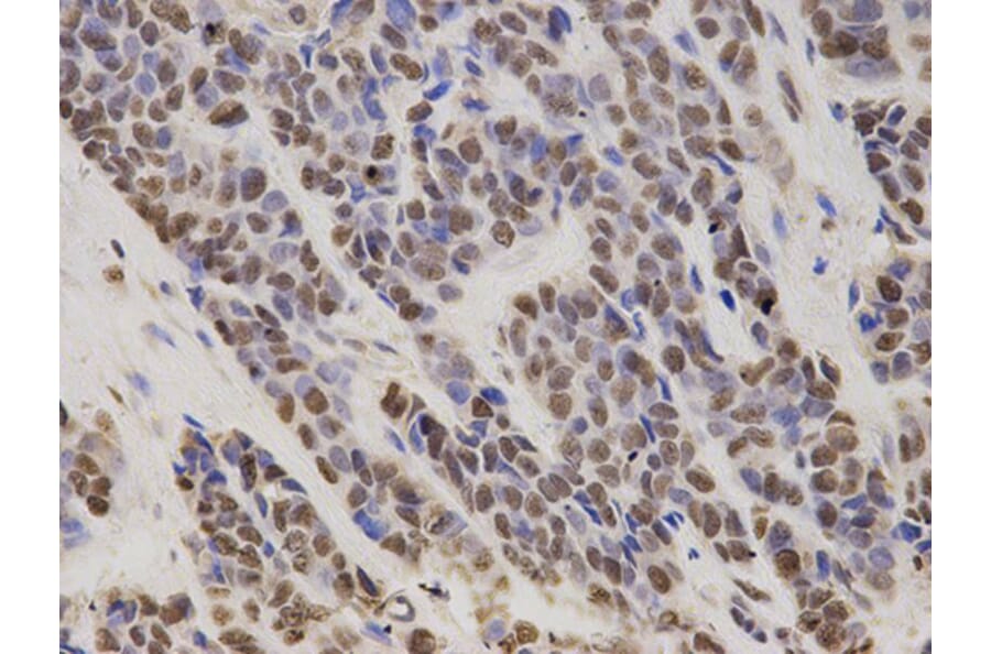 Immunohistochemistry - HDGF Antibody from Signalway Antibody (32788) - Antibodies.com