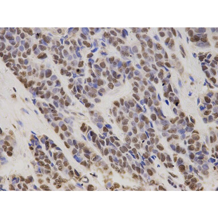 Immunohistochemistry - HDGF Antibody from Signalway Antibody (32788) - Antibodies.com
