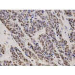 Immunohistochemistry - HDGF Antibody from Signalway Antibody (32788) - Antibodies.com