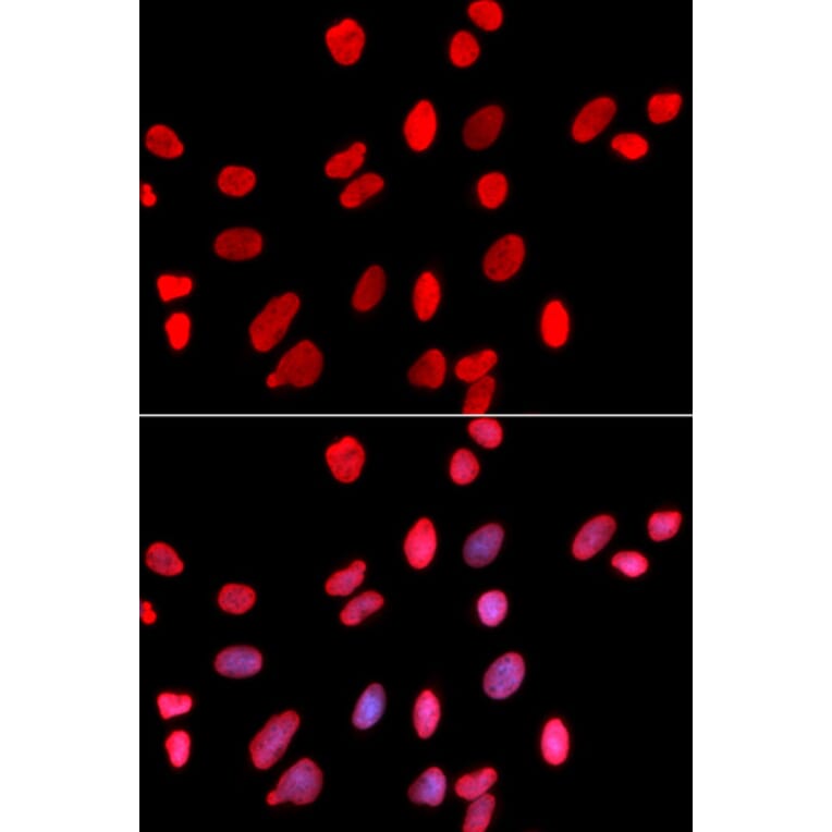 Immunofluorescence - HDGF Antibody from Signalway Antibody (32788) - Antibodies.com