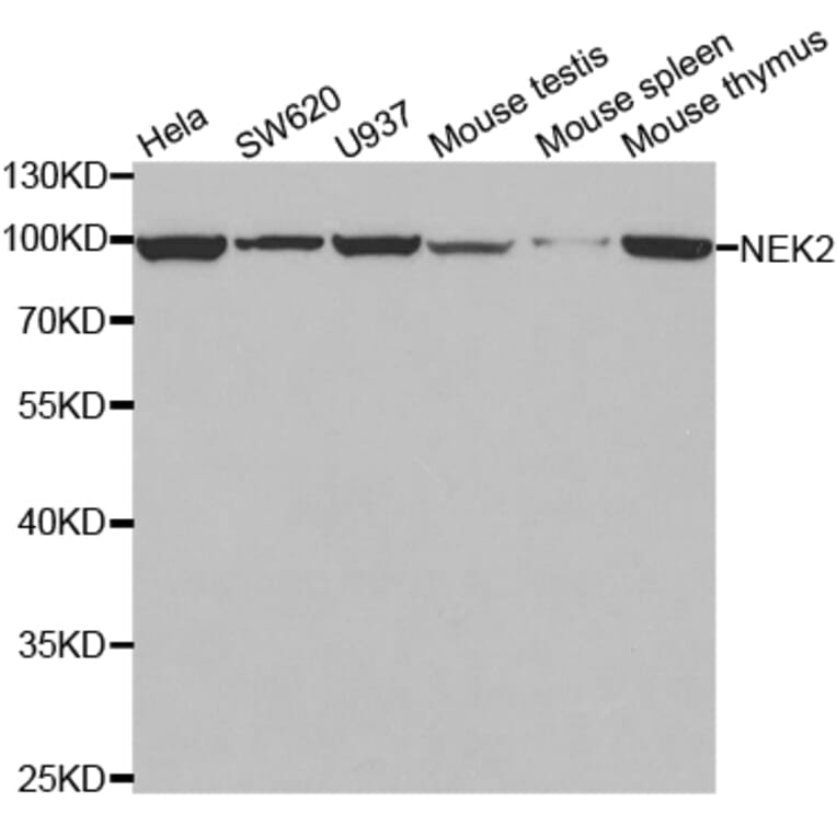 Western blot - NEK2 Antibody from Signalway Antibody (32795) - Antibodies.com