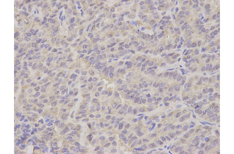 Immunohistochemistry - NEK2 Antibody from Signalway Antibody (32795) - Antibodies.com
