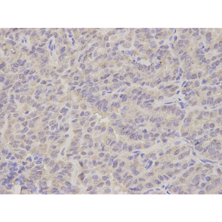 Immunohistochemistry - NEK2 Antibody from Signalway Antibody (32795) - Antibodies.com