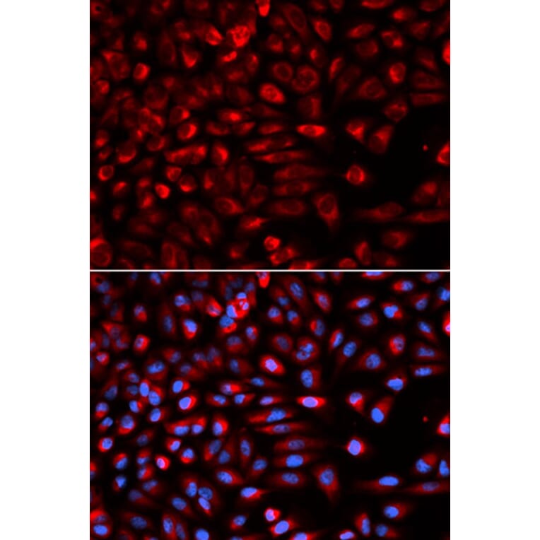 Immunofluorescence - NEK2 Antibody from Signalway Antibody (32795) - Antibodies.com