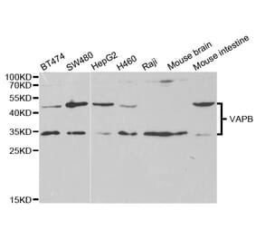 Western blot - VAPB Antibody from Signalway Antibody (32803) - Antibodies.com