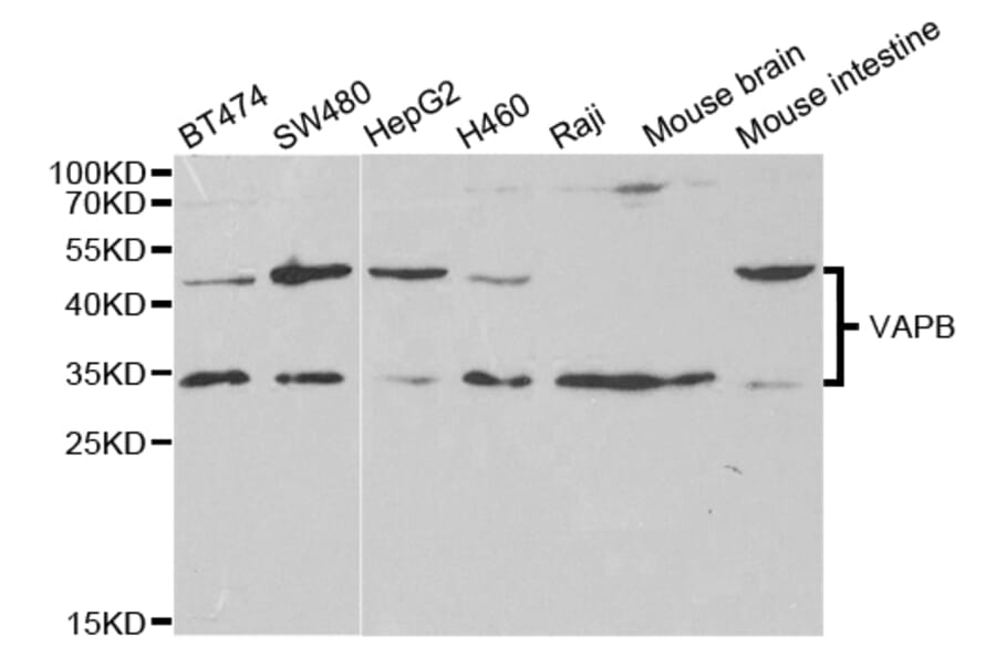 Western blot - VAPB Antibody from Signalway Antibody (32803) - Antibodies.com