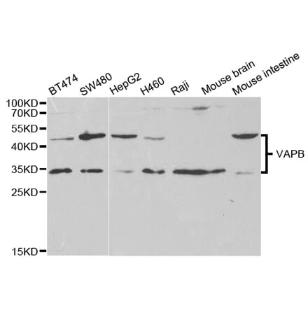 Western blot - VAPB Antibody from Signalway Antibody (32803) - Antibodies.com