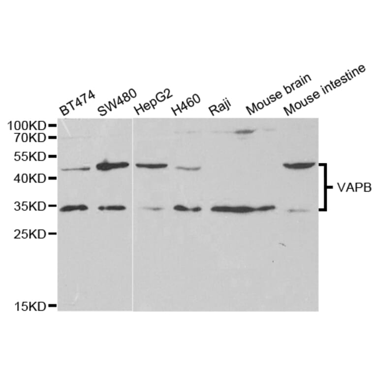 Western blot - VAPB Antibody from Signalway Antibody (32803) - Antibodies.com
